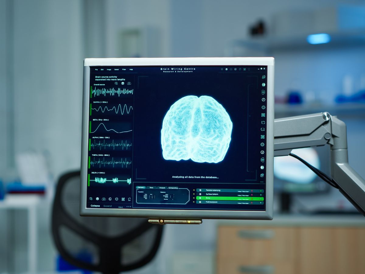 mapeo ondas cerebrales 2